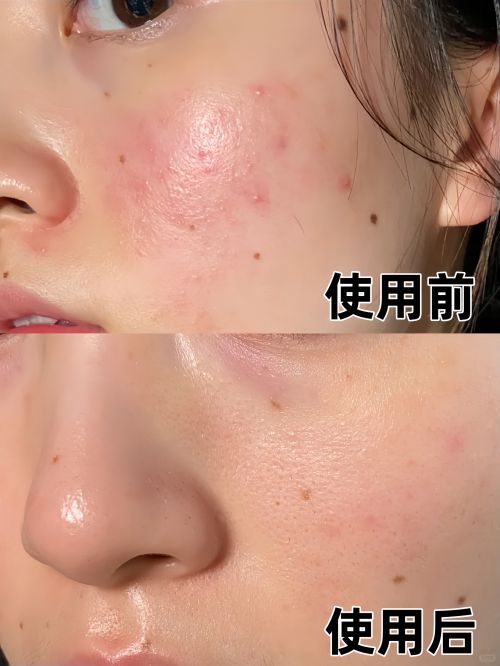 霜十大适合追求年轻肌肤的人J9真人游戏第一品牌抗皱面(图1)