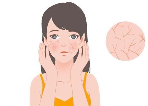 特护霜：修护敏感肌肤重塑健康屏障九游会登录j9入口第二代薇诺娜(图3)